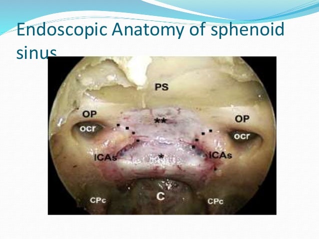 Endoscopic Anatomy of the Paranasal Sinuses
